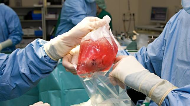 Nierentransplantation34