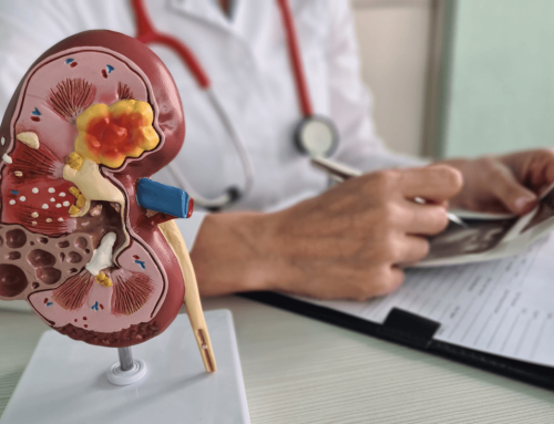 Atrasentán ralentiza el deterioro renal en adultos con nefropatía por IgA