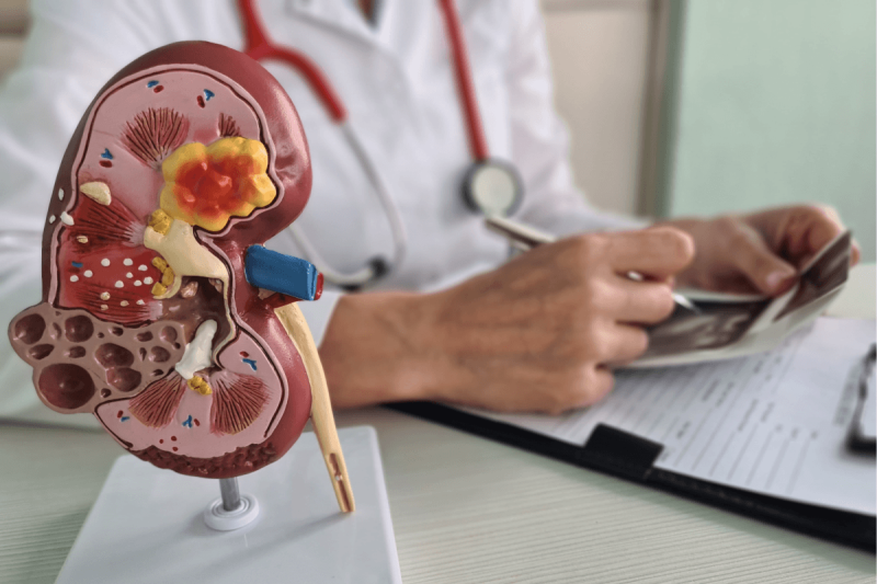immedicohospitalario_atrasentan-ralentiza-el-deterioro-renal-en-adulto_56770_05092237